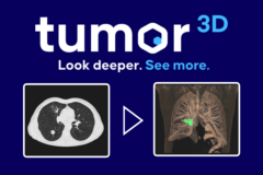 Tumor3D